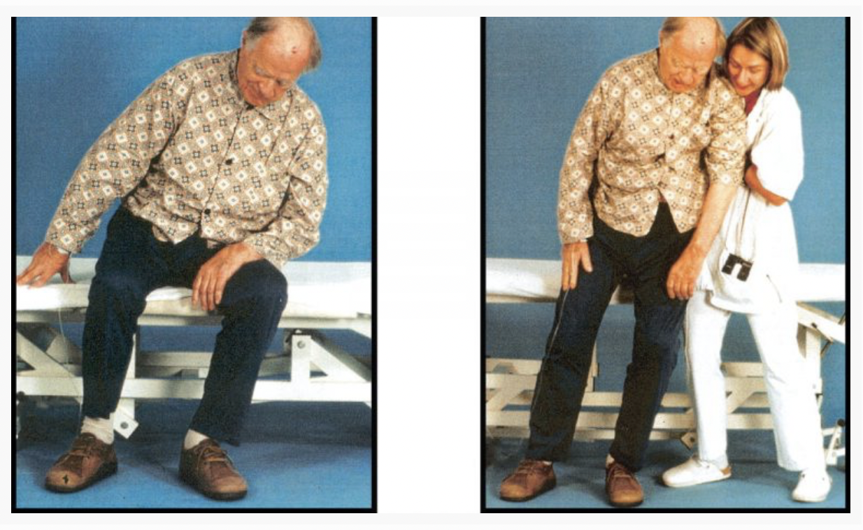 sindrome empujador interfaz cerebro-ordenador,recoveriX